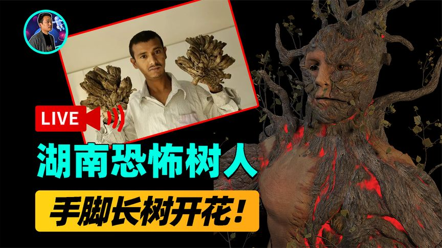 纪录片 湖南农民手脚长树开花 爆炸后气味难闻,村民传言是遭树神诅咒?-AI电影文案解说网